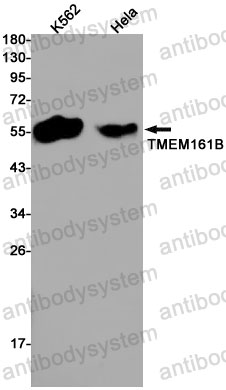 Anti-TMEM161B Antibody (R2S77)