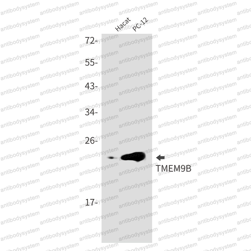 Anti-TMEM9B Antibody (R2S78)
