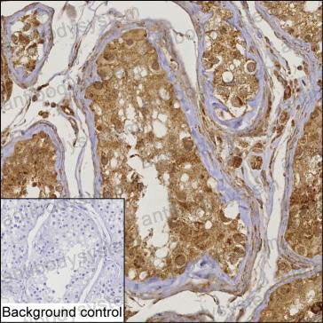 Anti-TSNAX Antibody (R4A52)