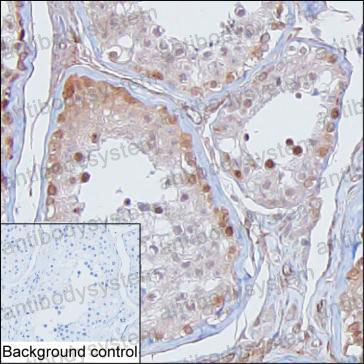 Anti-TSNAX Antibody (R4A53)