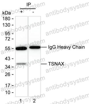 Anti-TSNAX Antibody (R4A51)