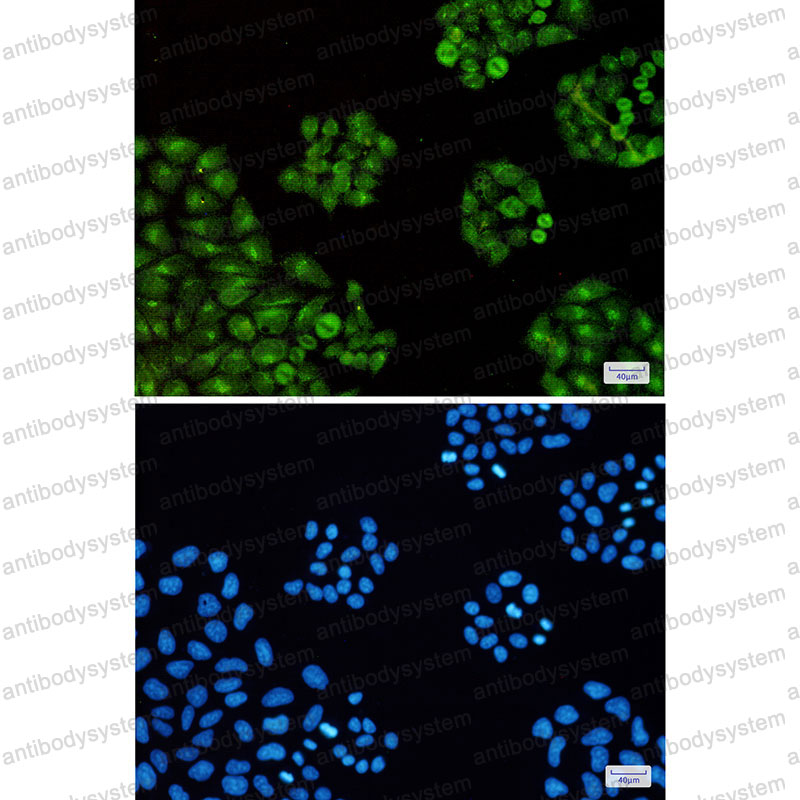 Anti-TTF2 Antibody (R2S80)