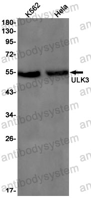 Anti-ULK3 Antibody (R2S81)