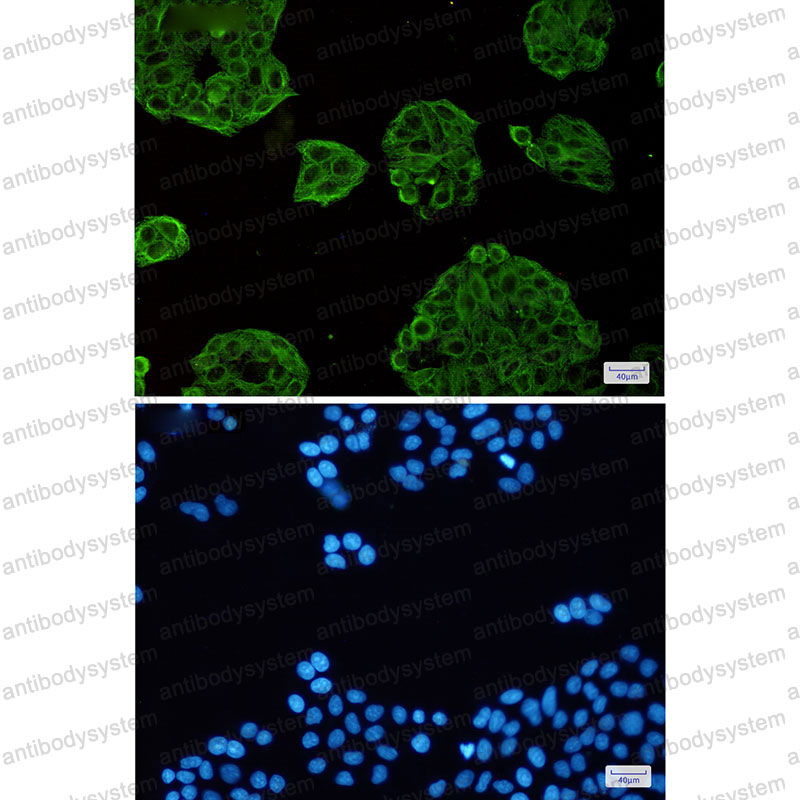 Anti-VPS4A Antibody (R2S82)