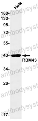 Anti-RBM43 Antibody (R2S85)