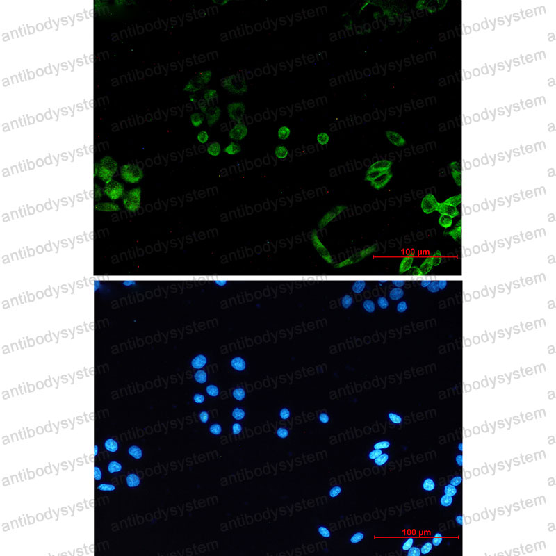 Anti-PACSIN3 Antibody (R2S86)