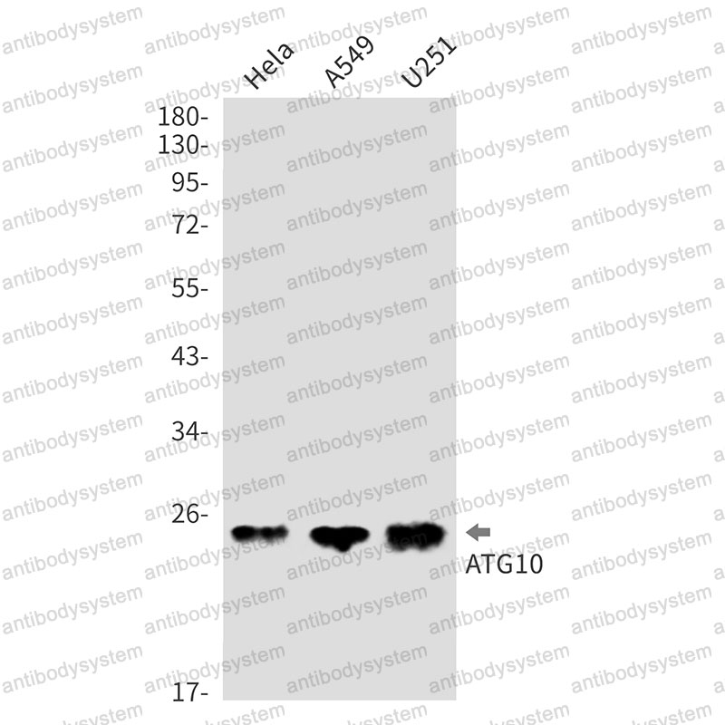 Anti-ATG10 Antibody (R2S88)