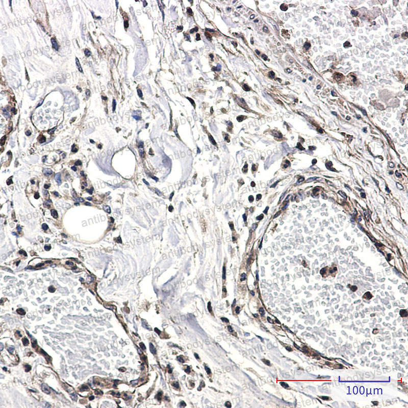 Anti-CAB39 Antibody (R2S91)