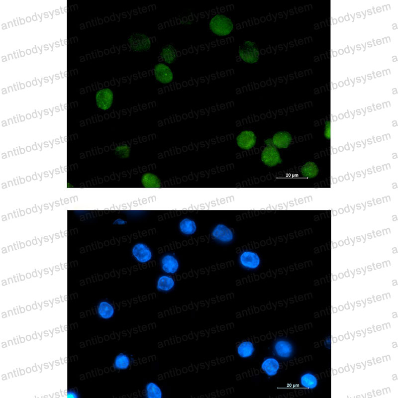 Anti-DAXX Antibody (R2S92)