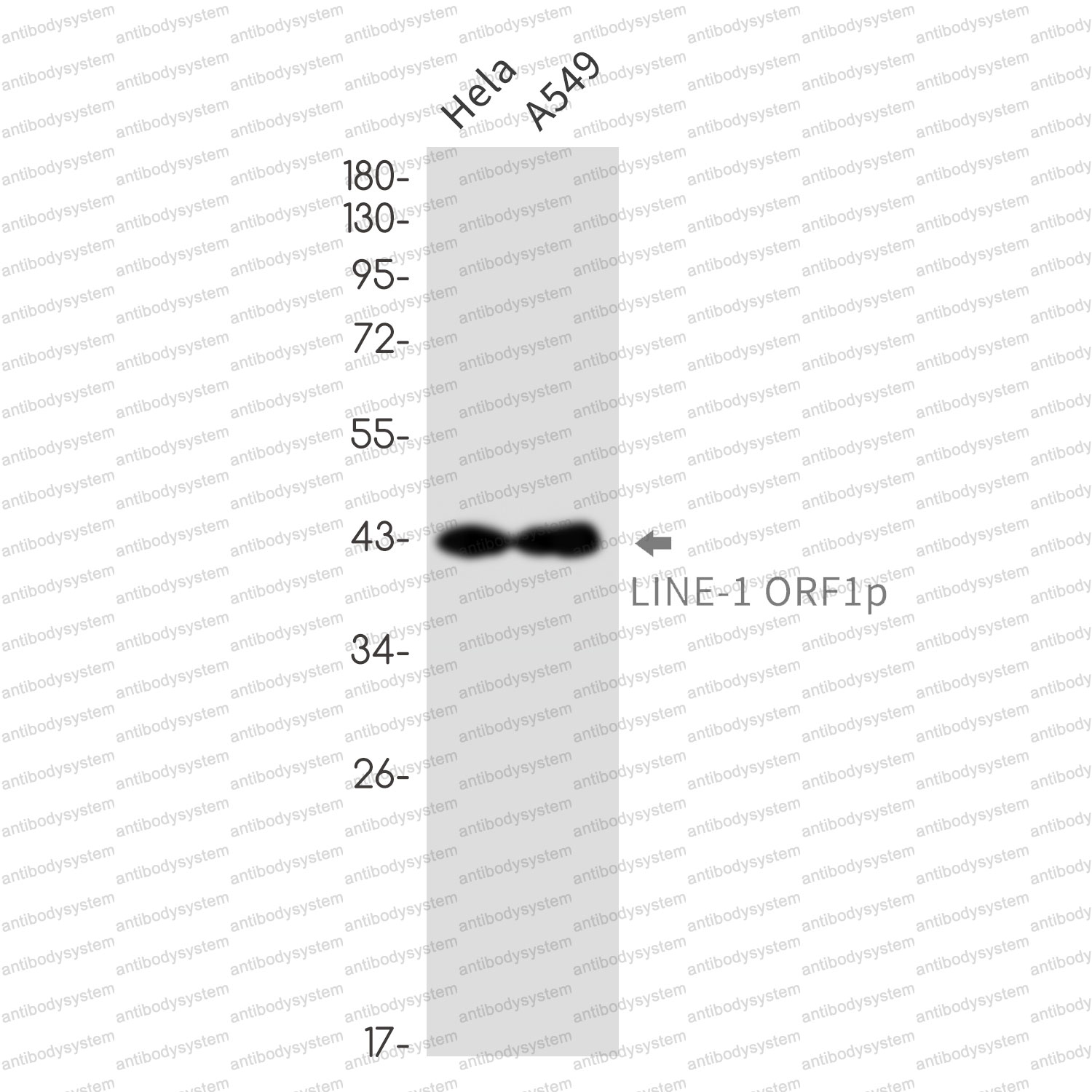 Anti-L1RE1 Antibody (R2S96)