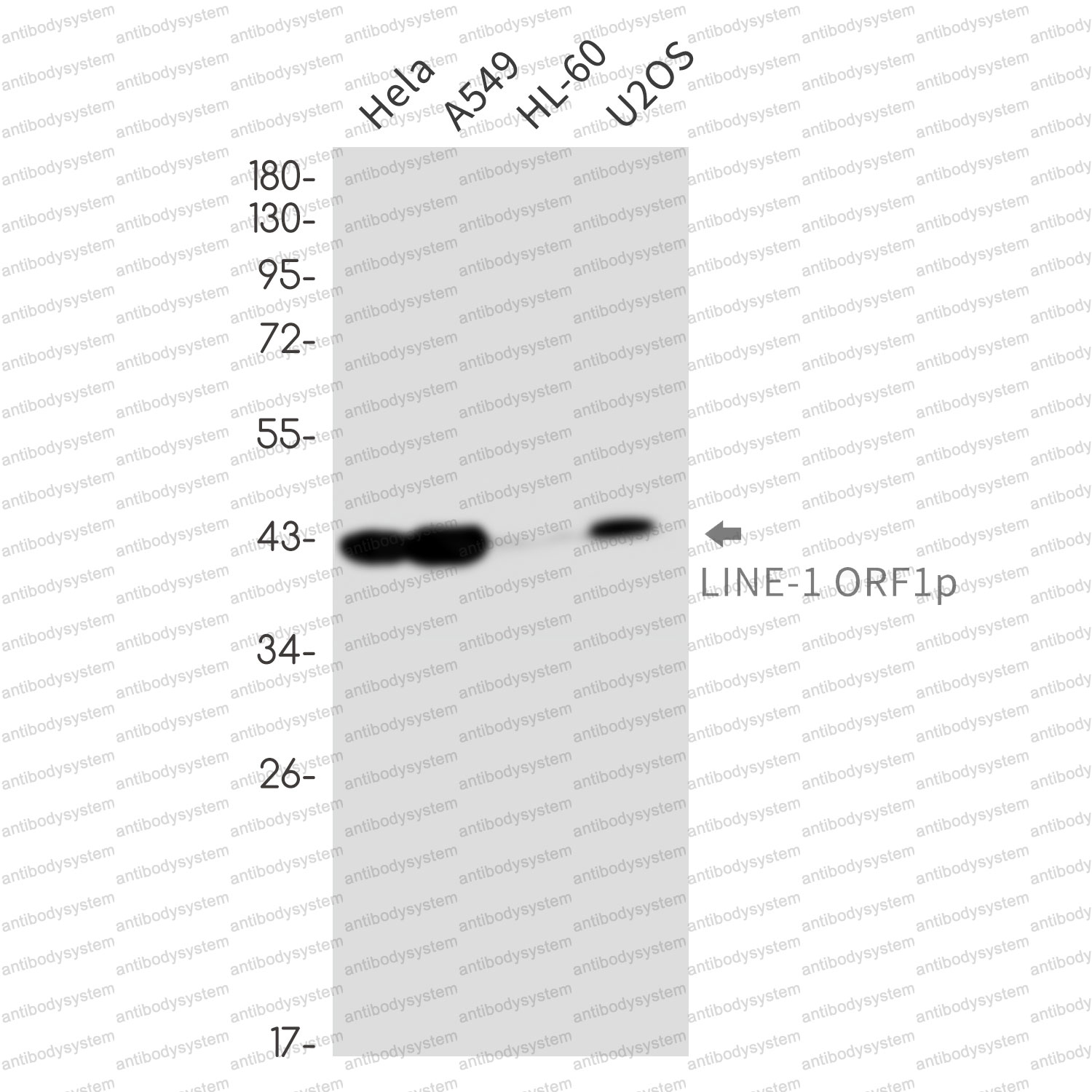 Anti-L1RE1 Antibody (R2S95)