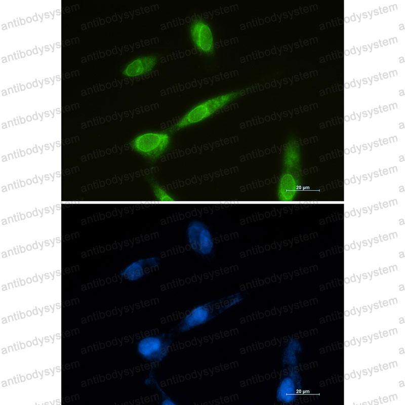 Anti-MTDH Antibody (R2S98)