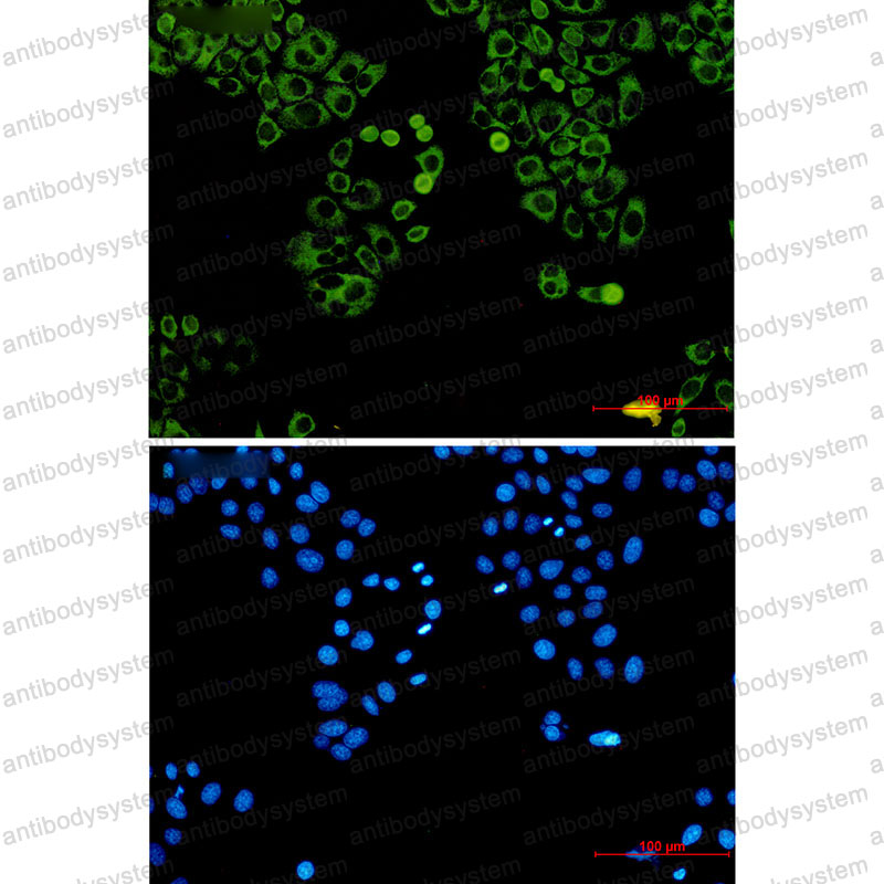 Anti-MTDH Antibody (R2S97)