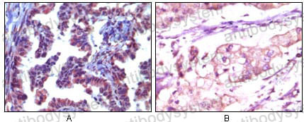 Anti-TRIM5 Antibody (R4A70)