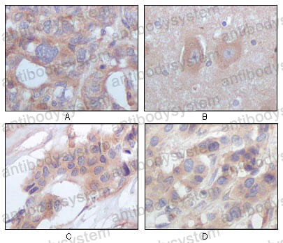 Anti-STYK1 Antibody (R4A73)