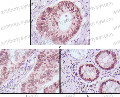 Anti-FOXA2 Antibody (R4A79)