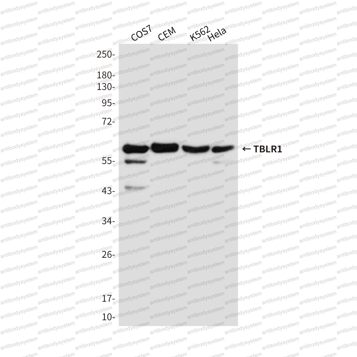 Anti-TBLR1 Antibody (R4A81)