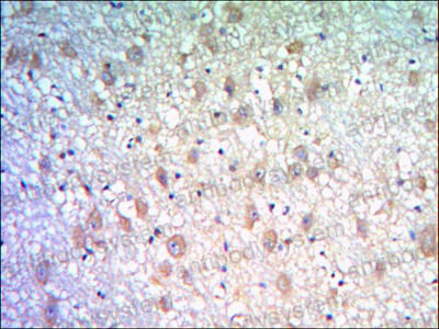 Anti-KLHL21 Antibody (R4A83)