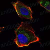 Anti-HAS1 Antibody (R4A87)