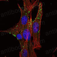 Anti-KLHL1 Antibody (R4A90)