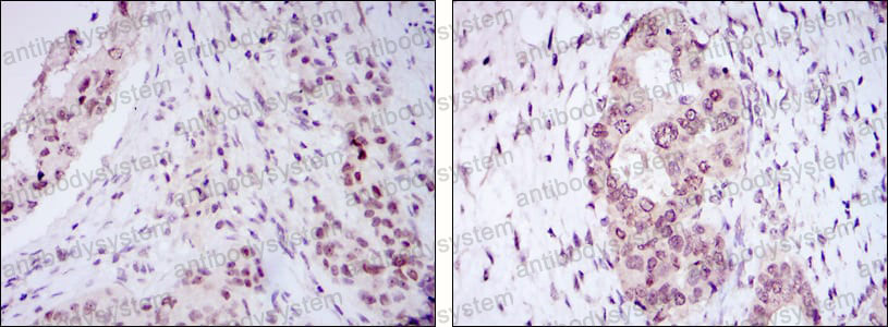 Anti-NACC1 Antibody (R4A93)