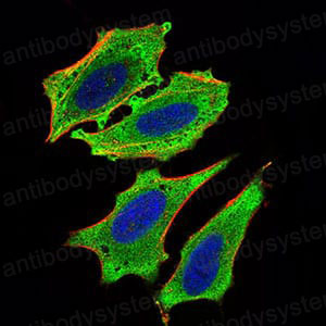 Anti-MLXIPL Antibody (R4B13)