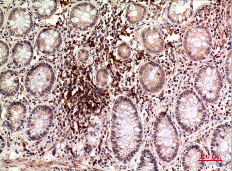 Anti-TUBE1 Antibody (R4B22)