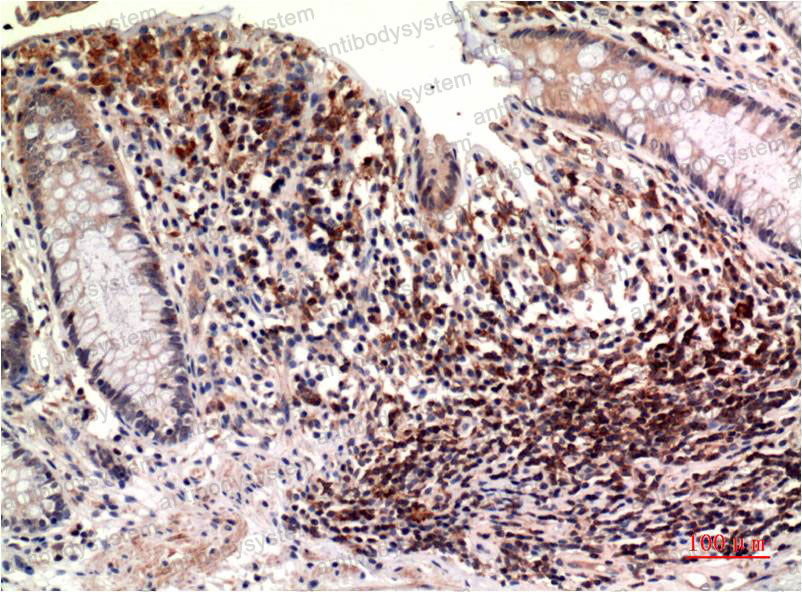 Anti-TUBE1 Antibody (R4B23)