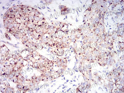 Anti-RAB6B Antibody (R4B46)