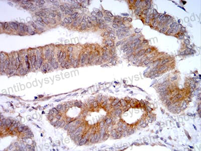 Anti-VIMP/SELENOS Antibody (R4B49)