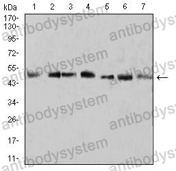 Anti-KLF2 Antibody (R4B51)