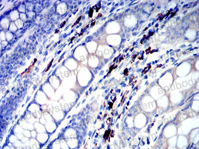 Anti-Human Lambda Light Chain Antibody (R4B60)