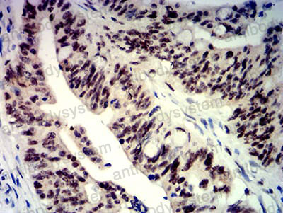 Anti-BTRC Antibody (R4B67)