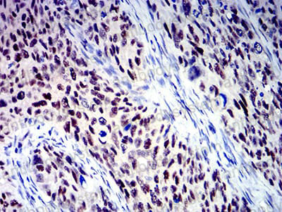 Anti-BCL9L Antibody (R4B71)