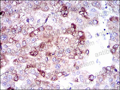 Anti-SLC27A5 Antibody (R4C19)