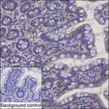 Anti-BLOC1S2 Antibody (R4C30)