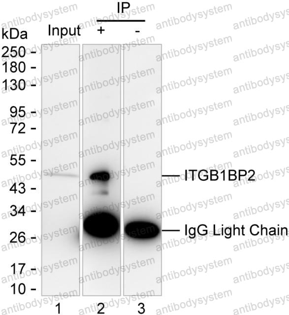 Anti-ITGB1BP2 Antibody (R4C34)