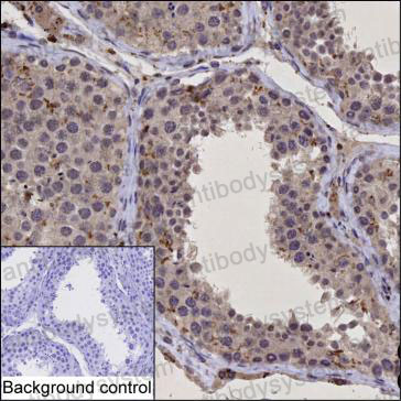 Anti-SPDL1 Antibody (R4C36)
