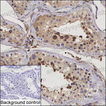 Anti-RNF133 Antibody (R4C37)
