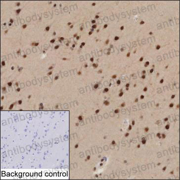 Anti-FOXJ3 Antibody (R4C40)