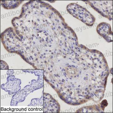Anti-TRIM34 Antibody (R4C42)