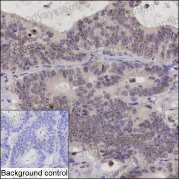 Anti-CCDC137 Antibody (R4C43)