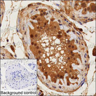 Anti-PSMD1 Antibody (R4C47)