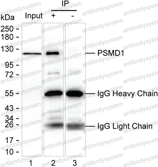 Anti-PSMD1 Antibody (R4C46)
