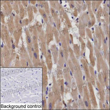 Anti-RNF207 Antibody (R4C48)