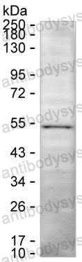Anti-RNF135 Antibody (R4C51)
