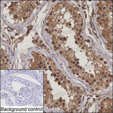 Anti-UBE2Z Antibody (R4C53)