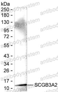Anti-SCGB3A2 Antibody (R4C57)