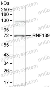 Anti-RNF139 Antibody (R4C58)