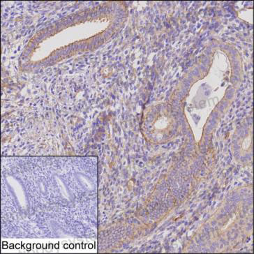 Anti-ENAH Antibody (R4C59)